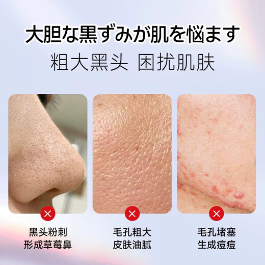 DIKTT Germany blackhead scraper, ultrasonic blackhead remover, electric acne scraper, blackhead suction tool, beauty instrument, pore cleaning, super suction to remove dead skin, gift for girlfriend, Honor Black, ultrasonic vibration + EMS firming + blackhead removal