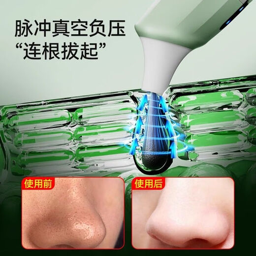 KONKA visual blackhead suction instrument cleaner electric blackhead instrument facial pore cleaning acne home beauty instrument tail cargo machine upgraded model direct pore attack two-speed operation