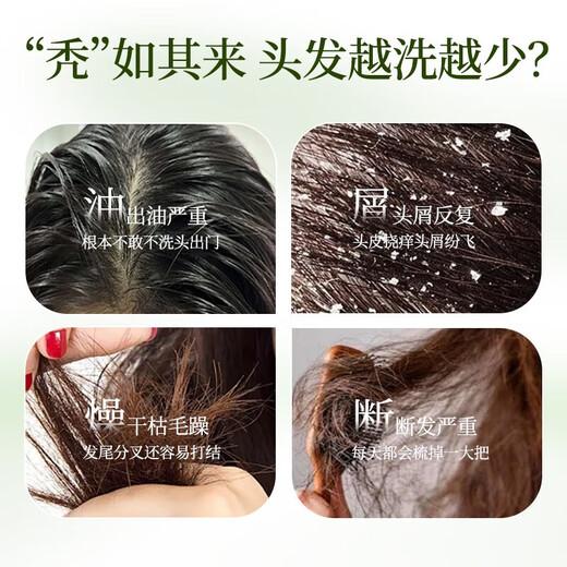 Seven Green Platycladus Leaf Shampoo Soap Usman Grass Shampoo Soap Polygonum multiflorum Chinese herbal medicine to prevent hair breakage, control oil, remove dandruff and fluffy 3 boxes