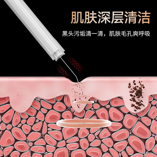 OES ultrasonic blackhead scraper, blackhead removal, acne cleaning instrument, skin peeling machine, household face and nose introduction beauty instrument to remove dead skin, birthday gift for girlfriend, LCD white, ultrasonic blackhead removal + EMS firming/cleansing, high frequency sound wave vibration + negative ion nutrition introduction