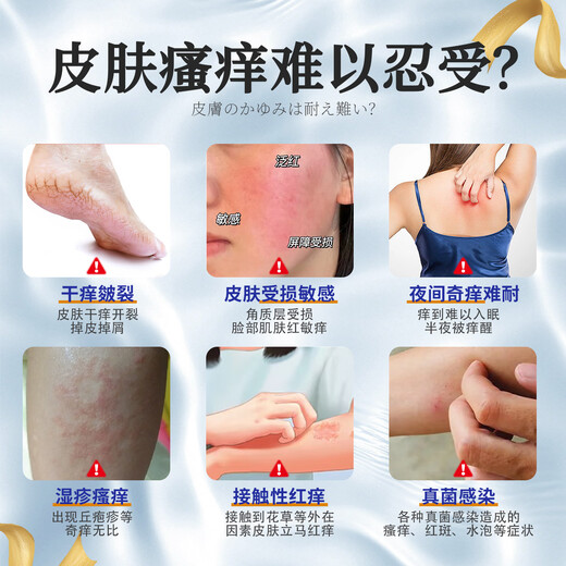 ASHK eczema plaster skin itching erythema antipruritic cream fungal infection sweat herpes anal itching 20g*1 box