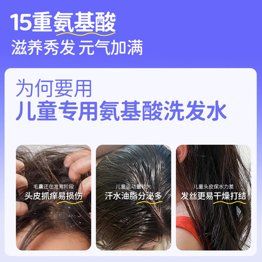 Feihu Brand Children's Amino Acid Shampoo for 3-6-12-15 years old, soft, gentle, oil-controlling, anti-dandruff, anti-itching, boys and girls, practical recommendation, two bottles (300g*2)