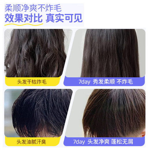 Feihu Brand Children's Amino Acid Shampoo for 3-6-12-15 years old, soft, gentle, oil-controlling, anti-dandruff, anti-itching, boys and girls, practical recommendation, two bottles (300g*2)