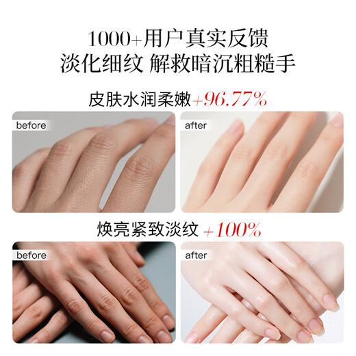 TAL Swiss TAL hand mask, whitening, moisturizing and hydrating hand gloves, repairs dry cracks and fades hand lines, classic whitening hand mask