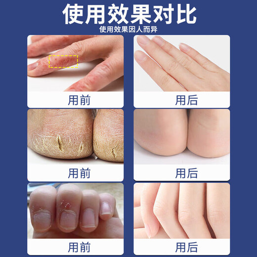Wuyang Snake Ointment Hand Cream Vaseline Hand Mask Dry and Rough Anti-Cracked Foot Cream Dry and Cracked Heels