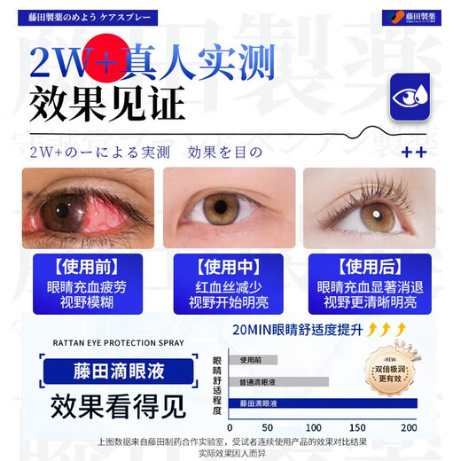 Fujita Pharmaceutical Japanese Lutein Eye Drops non-eye drops relieve eye fatigue, dry eyes, blurred vision, stay up late playing on mobile phone