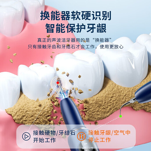 Sawang Germany Tooth Cleaner Household Calculus Remover Removes Smoke Stains and Yellowing Cleans Teeth Smoke Stains Tea Stains Tartar Calculus Scaler Dental Care Tool Silver White 3000W High Frequency Teeth Cleaning Protects Teeth and Gums
