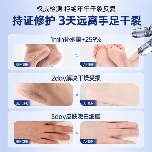 Japan's Dingding Foot Cracked Cream Gel-Free Heel Cracked Heel Cracked Heel Cracked Hand Repair Cream Hand and Foot Care 1 Bottle