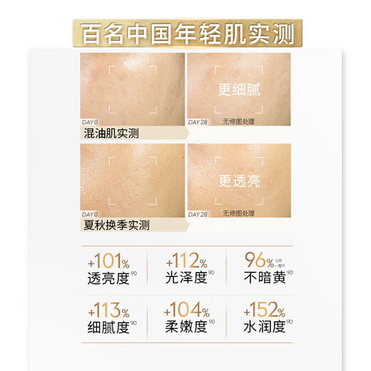 Olay (OLAY) new whitening water emulsion hydrating anti-sugar cosmetics toner skin care product set birthday gift for women