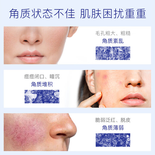 TAKAMI Double 11 spot small blue bottle essence 30ml, cuticle repair, acne removal, closed mouth, sensitive skin, hydrating and moisturizing