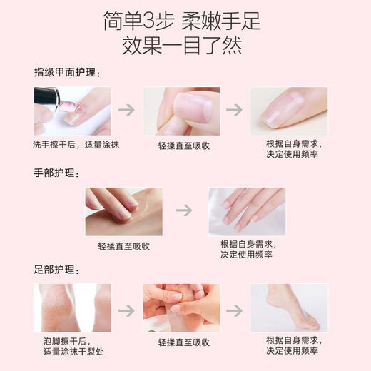 Miss Candy nail oil 10ml reduces and improves barbs, removes dead skin, strengthens nail surface, finger edge oil, grape seed nutritional oil NF006