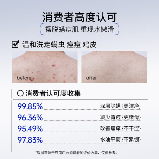 SUMDOY Japanese imported fruit acid shower gel removes mites, removes acne on the back, controls oil, relieves itching, moisturizes, and lasts for men and women. It is a great deal to remove mites every time, double cleansing, and care for the skin - two bottles