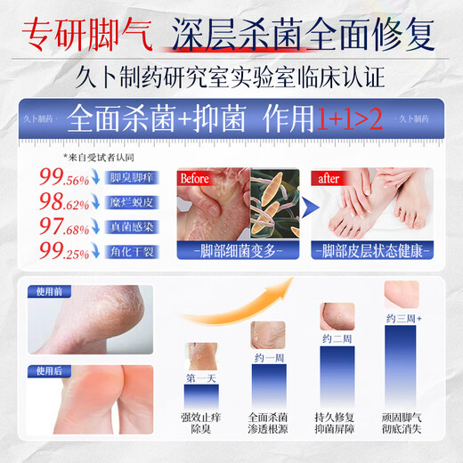 Jiub Pharmaceutical Athlete's Foot Spray to relieve itching, peeling, rotten feet, fungal infection, smelly feet, itchy feet, deodorant, anti-itching, sterilization and antibacterial 3 boxes