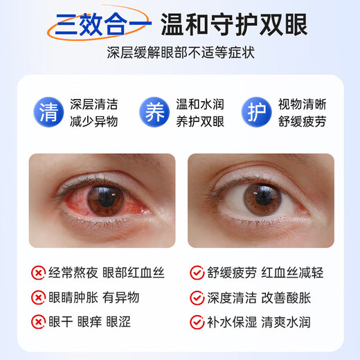 FIT MOMENT Lutein Eye Wash Non-Eye Drops Non-Eye Drops Fatigue Dry Eyes Blurred Vision Fatigue Stay Up Late 3 Bottles