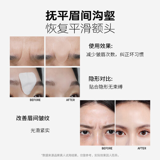 CandyMoyo Sichuan pattern invisible patch, anti-frowning and forehead wrinkle patch, magic tool to improve and fade wrinkles, nasolabial folds, firming and firming