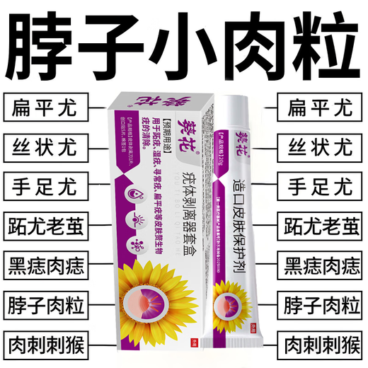 Sunflower wart exfoliation cream special for flat warts, filamentous condylomata acuminata, plantar warts, wart-type neck warts, fleshy granules 1 box (100% fast delivery)