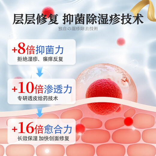 ASHK eczema plaster skin itching erythema antipruritic cream fungal infection sweat herpes anal itching 20g*1 box