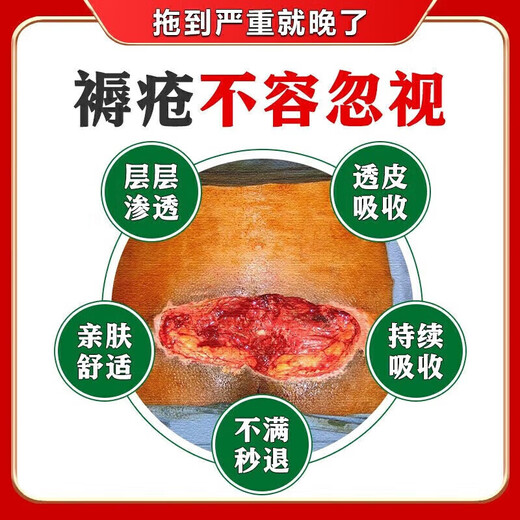 Decubitus Ointment Boric Acid Ointment treats pressure sores, pus, and ulcers, promotes healing, removes putrefaction, promotes muscle growth, trauma, and suppuration medicine. Blisters on old rotten legs and buttocks, long-term bed rest. 1 box. What to do about decubitus ulcers? Mild