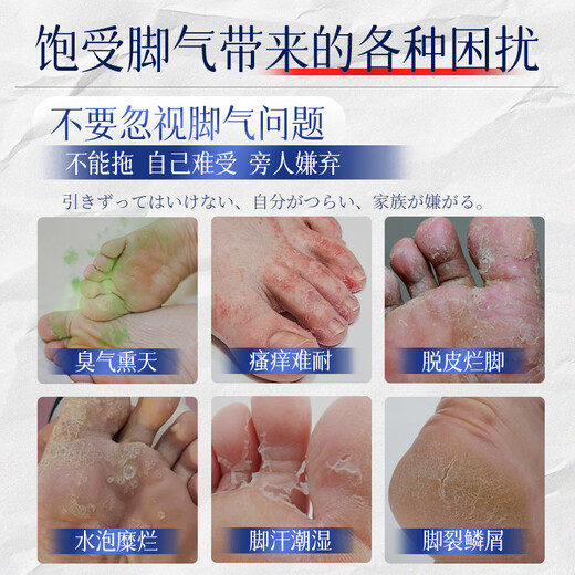 Jiub Pharmaceutical Athlete's Foot Spray to relieve itching, peeling, rotten feet, fungal infection, smelly feet, itchy feet, deodorant, anti-itching, sterilization and antibacterial 3 boxes