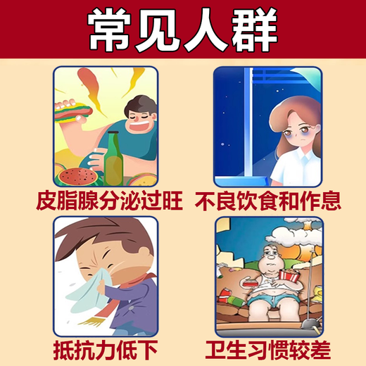 Erythromycin ointment, antibacterial, infection, anti-inflammatory and swelling fire boil special ointment, anti-inflammatory drug, anti-inflammatory and swelling fire boil removal ointment, fire boil, pustule, pimple, sebaceous gland cyst, boil, 3 boxes, long fire boil on the body, hard bag is particularly painful