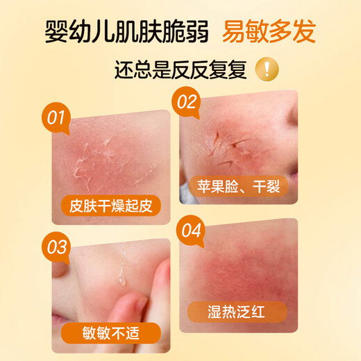 Niuqiang Children's Facial Cream Autumn and Winter Highly Moisturizing Anti-Clain Body Lotion Lightweight and Portable Infant Moisturizing Moisturizing Essence Cream 85g