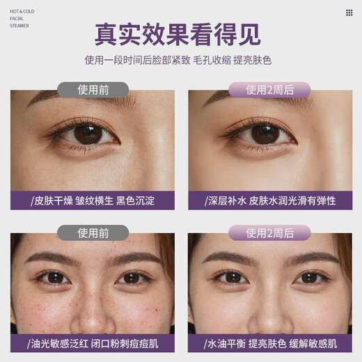 Verisa 2025 new facial steamer household hot and cold dual spray spray facial steamer shrink hair set two-in-one hot and cold facial steamer + blackhead device