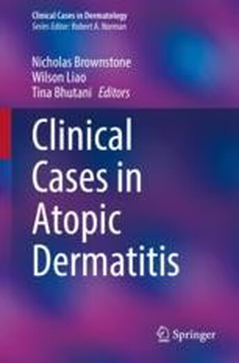 E-book Clinical Cases in A*ic Dermatitis