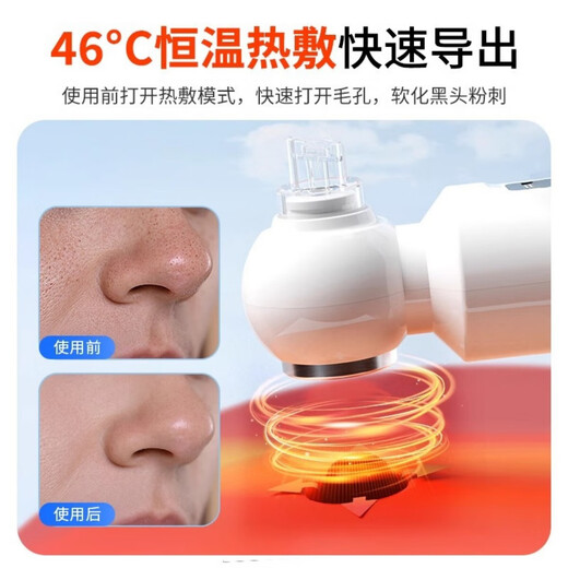 HYUNDAI small bubble blackhead suction instrument, electric blackhead suction instrument, beauty instrument, household facial pore cleaning aspirator, exclusive model, sewage separation + four skin types adjustment + oxygenated water circulation