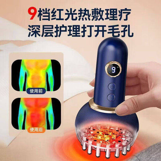 Sawang Germany electric gua sha instrument, cupping all-in-one machine, cupping, walking cup, hot compress to clear abdominal meridians, fully automatic walking cup, unblocking cup, New Year's gift for parents, top charging model, upgraded painless pressure relief, green + 99 levels of strength