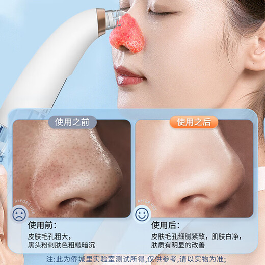 Blackhead extractor Blackhead suction instrument cleaning artifact facial small bubble cleaning and beauty instrument for men and women pore and acne cleaner Valentine's Day birthday gift for boyfriend and girlfriend Upgraded standard model 6 suction heads-3 gear modes-vacuum adsorption-enhanced suction power
