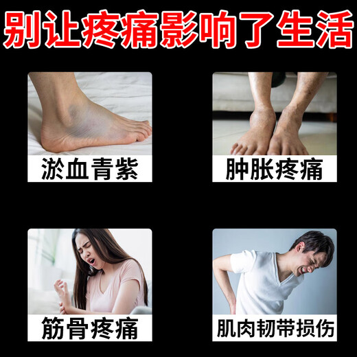 三七片 活血化瘀舒筋 治各种跌打损伤药消肿止痛镇痛关节扭伤擦伤损伤韧带拉伤淤血肿痛散淤止血消肿止痛药 壹盒装【扭伤挫伤 散瘀止血】推荐5盒装