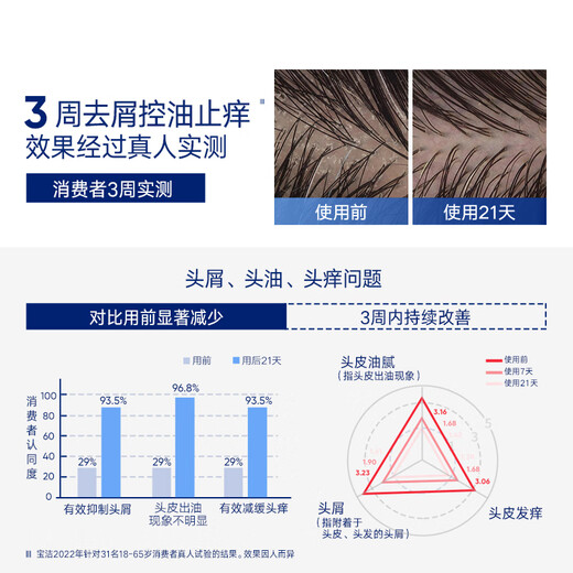 海飞丝专研去屑洗发水控油头皮护理男士女士洗发露洗头膏持久 【回购券】专研控油去屑80G