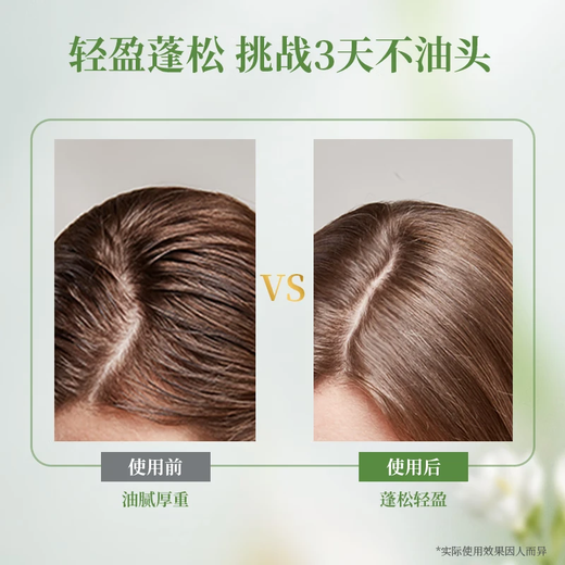 Aogu Shampoo Series [Expiration in April 26, please be careful when shooting] Plump and fluffy shampoo 260ml*2 bottles
