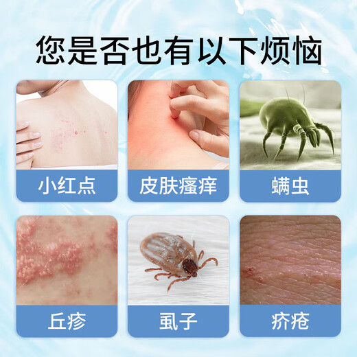 Yufutang sulfur ointment 30g*1 pubic lice private parts scrotum itching moist vulva and anus itching scabies men and women