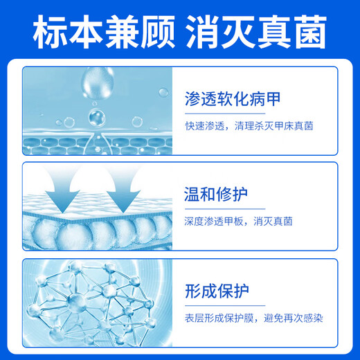 To correct onychomycosis, Chinese medicine can be used to cure nail fungal infection. New nail antibacterial solution 60ml for removing and destroying the nail.