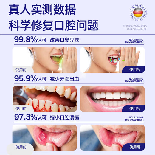 Warronson Medical Mouthwash Anti-inflammatory and Bacteria Removal of Bad Breathing Pylor Independent Small Package Portable Relieve Swelling and Pain Relieve Gum Hemorrhage Care