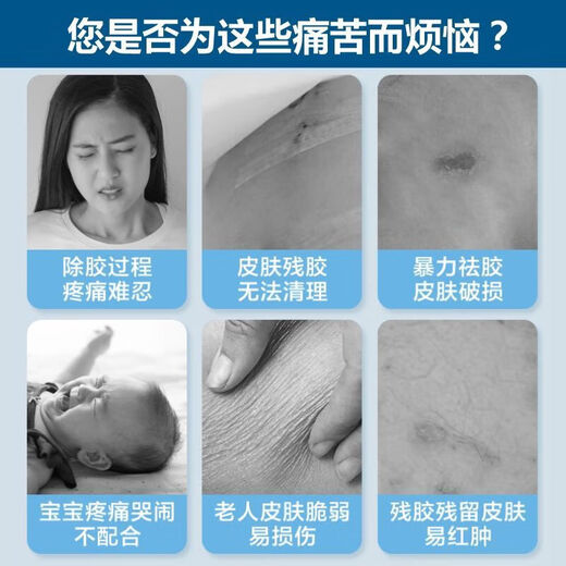 Mingkang12010黏胶祛和康乐保除胶剂12010除剂底盘剥离去胶剂进口医用（看清品牌选项下单 【1瓶】M12010剥离剂50ml