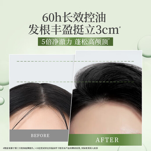 Seeyoung Ginger Shampoo Silicone-free Washing Set Refreshing Oil Control Fluffy Anti-dandruff Anti-Itch Anti-washing Hair Paste Oil Control Cleansing Set 400ml*3 Bottles + Mu 500m