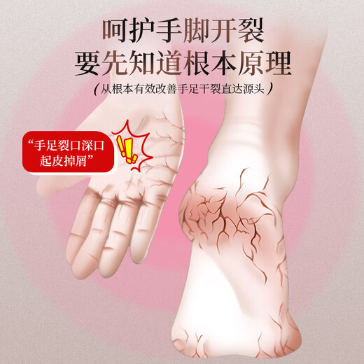 Ice King Cracked Cream Hand and Foot Anti-Cracked Foot Cream 70g Heel Cracked Fungus Hand Cracked Cracked Cracked Infection Foot Protection Cream