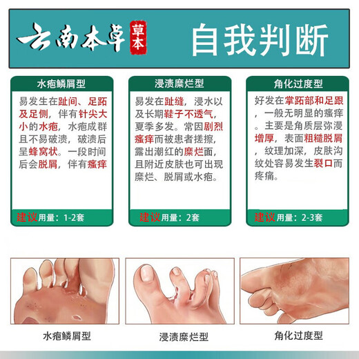 Yunnan Materia Medica, athlete's foot, foot odor relief, soothing itchy feet, rotten odor, fungal infection, skin antibacterial spray 60ml + cream 20g