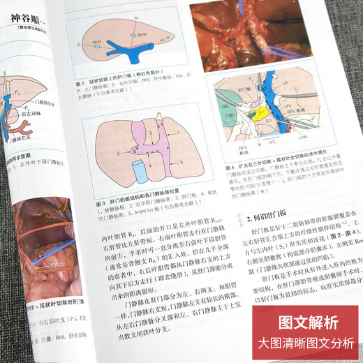 Puntos clave y puntos ciegos de cirugía biliar, 2ª edición, Dong Jiahong, Cirugía, People's Health Press, 9787117115919 15919