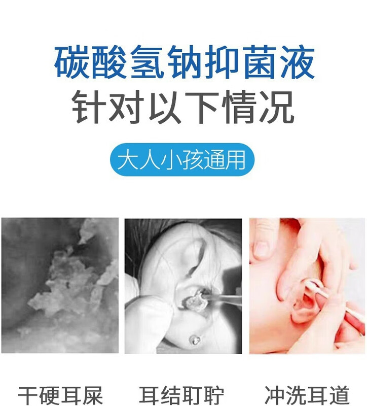 Xunbeikang Sodium Bicarbonate Ear Drops for Children, Iron Ear Wax Softening Baby Cerumen Water Liquid Ear Wax Baby Ear Removal Artifact, Single Bottle (Available Over One Year Old) (Bottle/10ml)