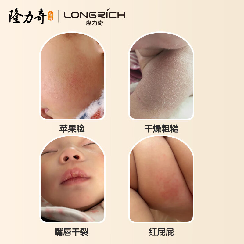 Longliqi children's snake oil moisturizing cream snake oil stick facial cream autumn and winter anti-drying and cracking soothing moisturizing cream