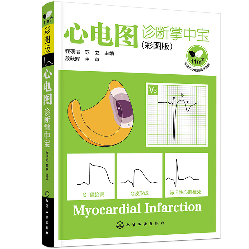 ECG Diagnosis in the Palm (Color Picture Version)