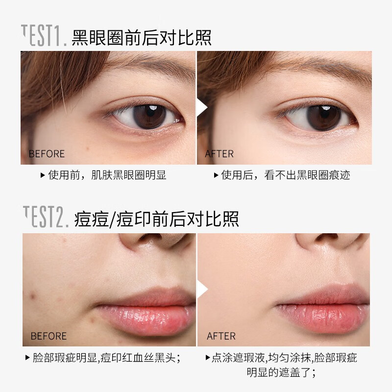 Amy three-color concealer to cover dark circles, freckles, acne marks, contouring face concealer palette, air version, moisturizing version 01# natural color