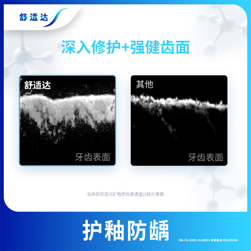 Sensodyne Speed Care Toothpaste 180g, anti-allergic, fluoride-containing, anti-moth and gum protection, new and old packaging shipped randomly