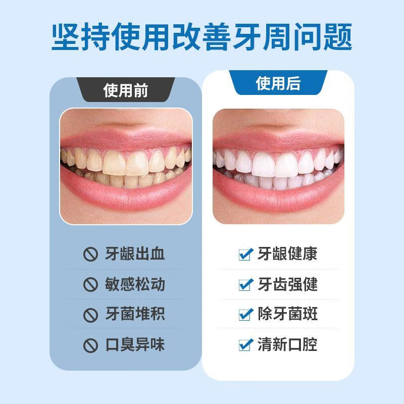 Baiyunshan official direct sale desensitizing toothpaste, medical for gum bleeding, swelling and pain, hot and cold, sweet and sour for toothache, sensitive teeth, hot and cold, sweet and sour, 1 tube of desensitizing cream to relieve allergies, no gift with purchase