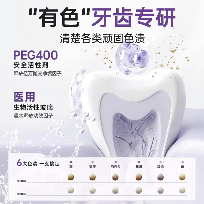 SOVIP Germany's dental calculus cleaning artifact removes bad breath, removes yellow tooth stains, removes tobacco stains, and is the first in the gold list for non-toothpaste adults