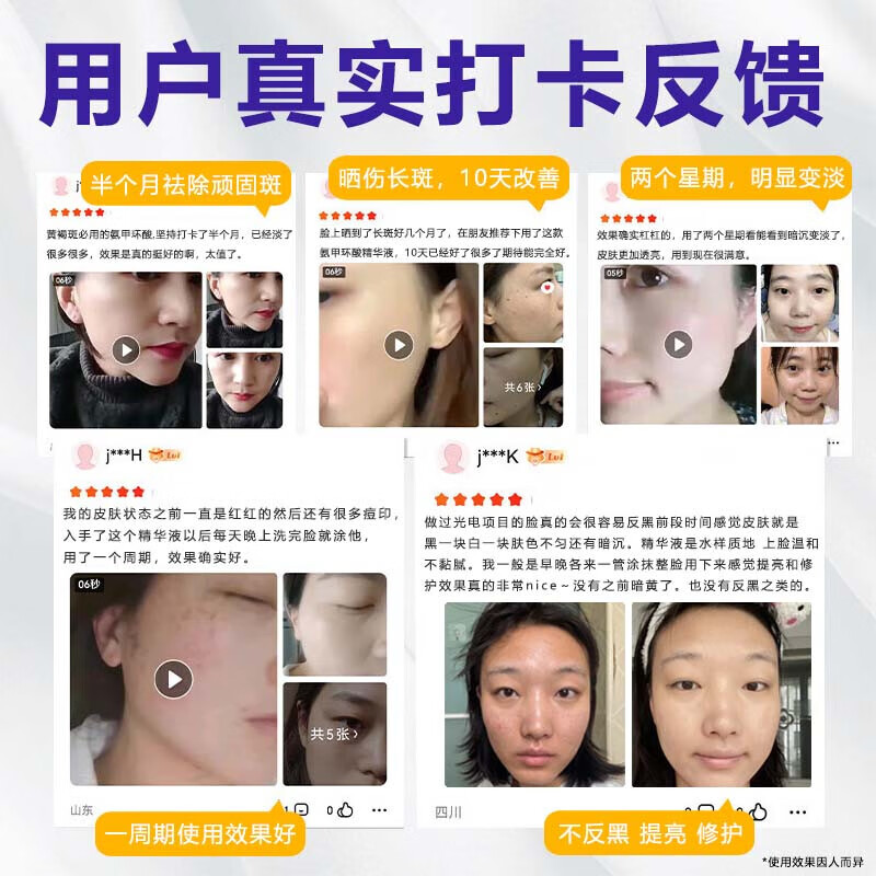 Skin grass set tranexamic acid essence tranexamic acid 5% high concentration wet compress chloasma nicotinamide original solution