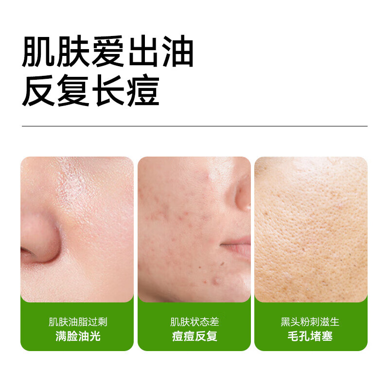 MANTING Mite Clearing Soap, Oil Control and Acne Removal (100g) (Mite Removing Soap Fei Sulfur Hand Cleansing and Bathing Soap)